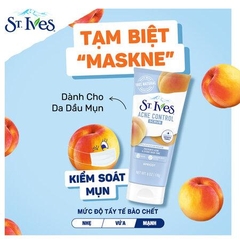 Sữa Rửa Mặt St.Ives 170g