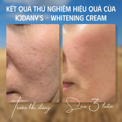WHITENING CREAM
