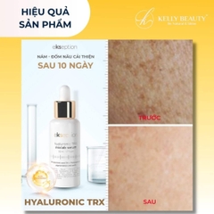 [HÀNG NHẬP KHẨU] Serum sáng da, mờ nám EKSEPTION Hyaluronic TRX Serum 75ml