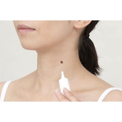 Tsubuporon - Kem Trị Mụn Thịt, Nốt Ruồi 20g