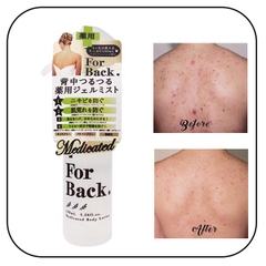 Gel trị mụn lưng For Back dạng xịt