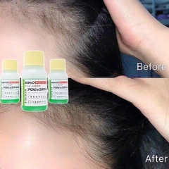 Sato - Tinh Chất Thảo Dược Kích Thích Mọc Tóc Sato Arovics Solutions 5% 30ml