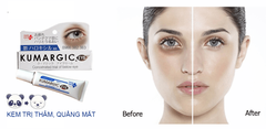 Kumargic - Kem Mắt Kumargic Xóa Thâm Quầng Và Bọng Mắt 20g