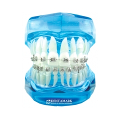 Hàm tư vấn bệnh lý, cầu răng, implant trong nha khoa - Hàm tư vấn 5 in 1