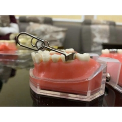 Bộ Matric Kèm Chêm (matrix)