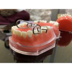 Bộ Matric Kèm Chêm (matrix)