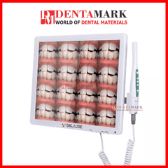 Camera Soi Răng 17" DALAUDE DA200