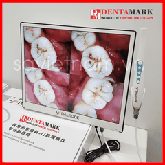 Camera Soi Răng 17" DALAUDE DA300