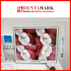 Camera Soi Răng 17" DALAUDE DA300