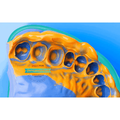 Cao su lấy dấu - Silicone Lỏng Silagum light (DMG)