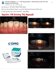 Tẩy đốm trắng Icon DMG – Bộ Kit loại bỏ đốm trắng bằng Icon Smooth Surface