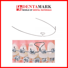 Dây cung Tloop - Ortho Technology (Dây SS)