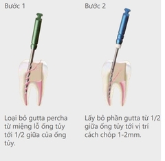 File lấy Gutta Percha trong tái điều trị tủy GPR - Mani