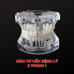 Hàm tư vấn bệnh lý, cầu răng, implant trong nha khoa - Hàm tư vấn 5 in 1