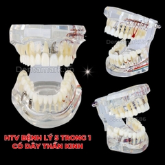 Hàm tư vấn bệnh lý, cầu răng, implant trong nha khoa - Hàm tư vấn 5 in 1 có dây thần kinh