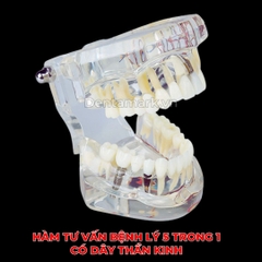 Hàm tư vấn bệnh lý, cầu răng, implant trong nha khoa - Hàm tư vấn 5 in 1 có dây thần kinh
