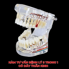 Hàm tư vấn bệnh lý, cầu răng, implant trong nha khoa - Hàm tư vấn 5 in 1 có dây thần kinh