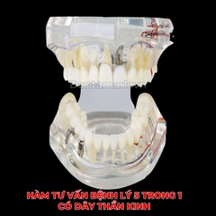 Hàm tư vấn bệnh lý, cầu răng, implant trong nha khoa - Hàm tư vấn 5 in 1 có dây thần kinh