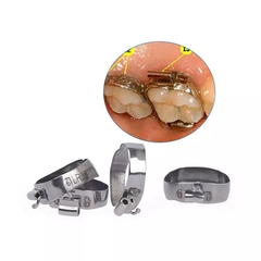Hộp Band Chỉnh Nha Roth 0.022 Đủ Số 80 Cái