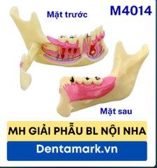 Mô hình giải phẫu bệnh lý nội nha