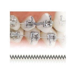Lò Xo Mở Khoảng NiTi Thẩm Mỹ DynaFlex .010×.030