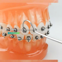 Mắc cài kim loại cánh cam tự khóa HanOrtho (tự buộc) (MUA 5 TẶNG 1)