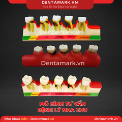 Mô hình tư vấn bệnh lý nha chu