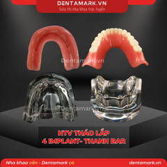 Hàm tư vấn tháo lắp 4 Implant với T Bar Silver - Mẫu hàm tháo lắp trên Implant (Implant All On 4 - T-Bar Silver )