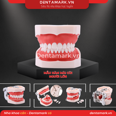 Hàm thực hành mài cùi răng người lớn