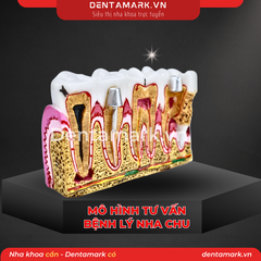 Mô hình tư vấn bệnh lý nha chu - Nội nha M4019