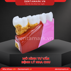 Mô hình tư vấn bệnh lý nha chu - Nội nha M4019