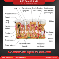 Mô hình tư vấn bệnh lý nha chu - Nội nha M4019