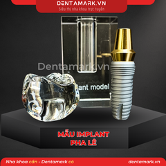 Mô hình Implant pha lê