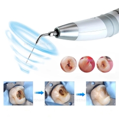Máy rung rửa nội nha Endo 3 – Woodpecker