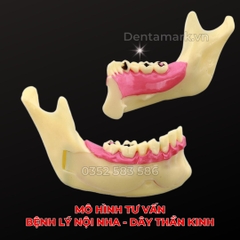 Mô hình giải phẫu tư vấn bệnh lý nội nha - Dây thần kinh