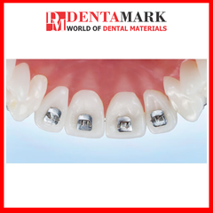 Nút chặn đẩy lưỡi - Gói 10 cái