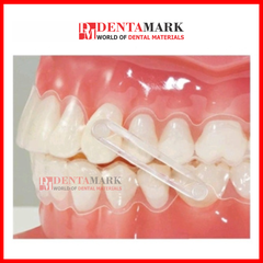 Nút dán button thẩm mỹ button sứ - Gói 10 cái