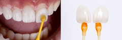 Que Dính Giữ Veneer Ivoclar OptraStick – Hộp 48 Que