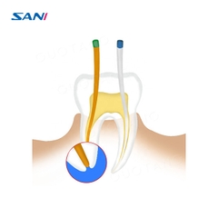 Gutta Sani F1 F2 F3 – Hộp 60 côn trám bít ống tủy