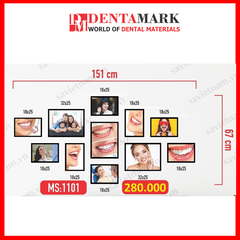 Set tranh trang trí nha khoa - Chất liệu formex