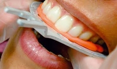 Silicone Lấy Dấu Khớp Cắn O-Bite DMG