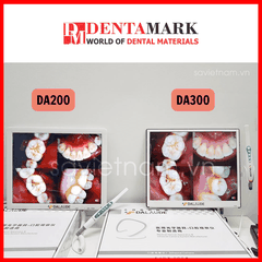 Camera Soi Răng 17" DALAUDE DA300