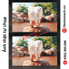 Tranh nha khoa để bàn gỗ tráng gương 20x30