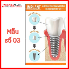 Tranh nha khoa Implant trang trí phòng khám