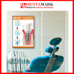 Tranh nha khoa Implant trang trí phòng khám