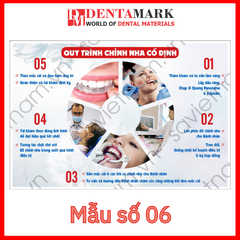 Tranh nha khoa - Tranh quy trình nha khoa: Bọc răng sứ, Cấy ghép implant, Chỉnh nha