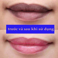 Son Dưỡng Trị Thâm Môi Mediheal Labocare Đủ Màu 10ml
