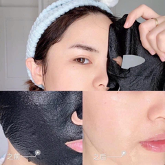Mặt Nạ Naruko Trà Tràm Kiềm Dầu Ngăn Ngừa Mụn Hộp 8 Miếng