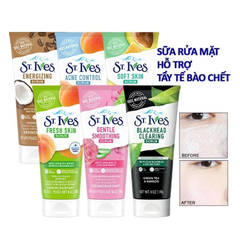 Sữa Rửa Mặt St.Ives Tẩy Tế Bào Chết 170g Acne Control Scrub Apricot