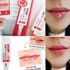 Son Dưỡng Trị Thâm Môi Mediheal Labocare Đủ Màu 10ml